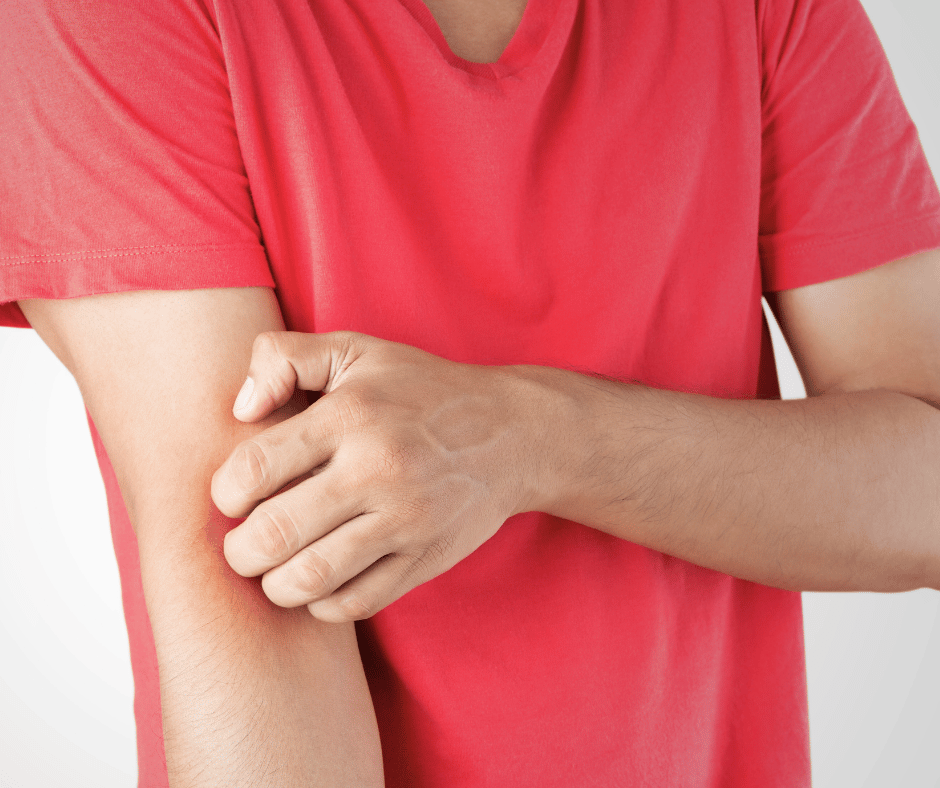 Fungal Infection Symptoms and Treatment PRESNow