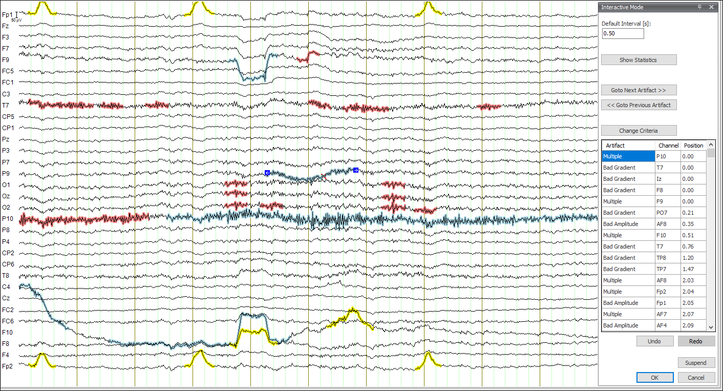 Getting to know EEG artifacts and how to handle them in BrainVision