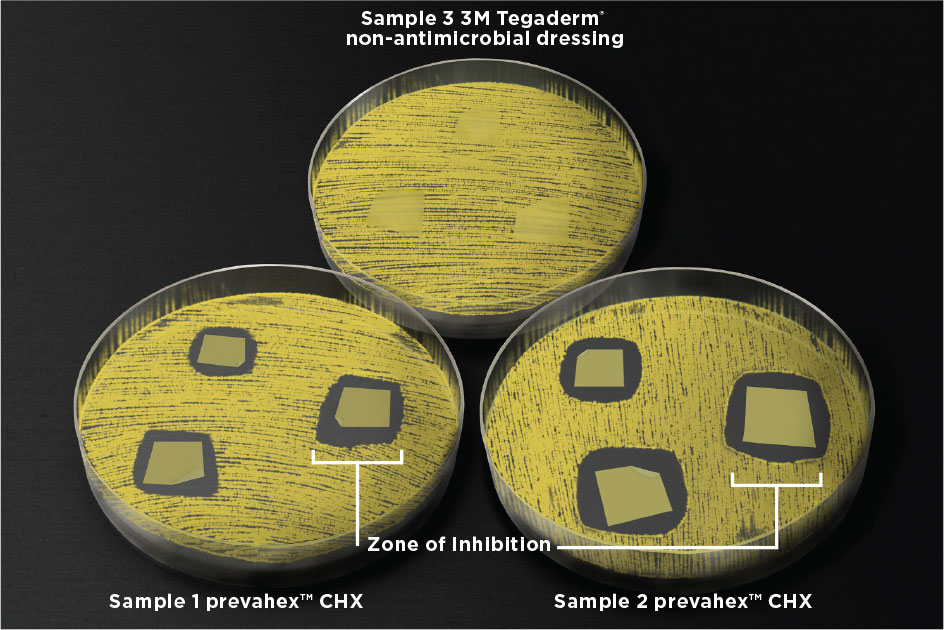 What Is A Zone Of Inhibition slidesharetrick