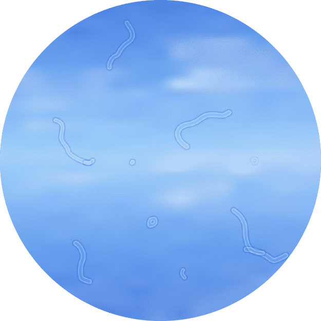 Diabetesrelated Retinopathy Prevent Blindness Texas