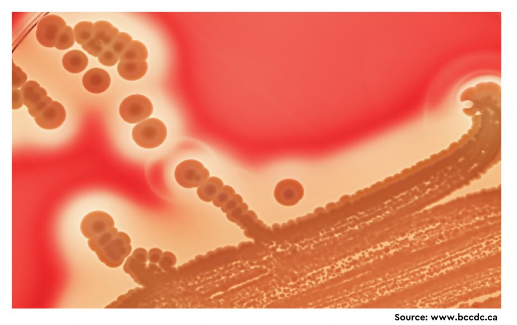 A Survey of Prevalence and Phenotypic and Genotypic Assessment of