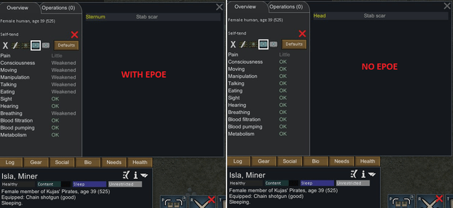 [1.0/1.1/1.2] Expanded Prosthetics And Organ Engineering 2.42 (27.08.2020)