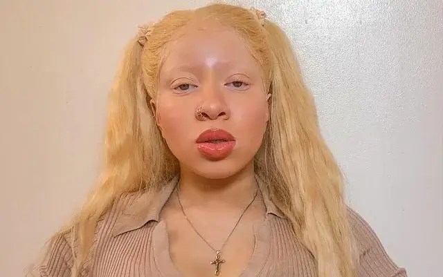 Cee Cee Model Wiki, Age, Instagram, Albinism