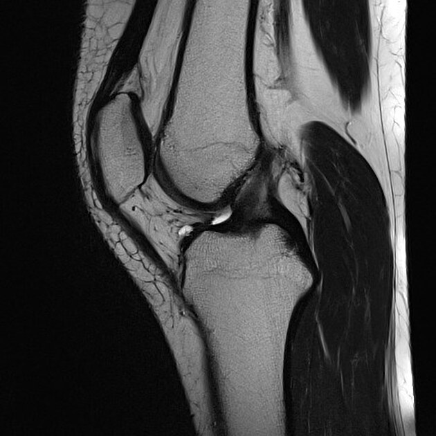 Knee MRI Scan Priority Diagnostics