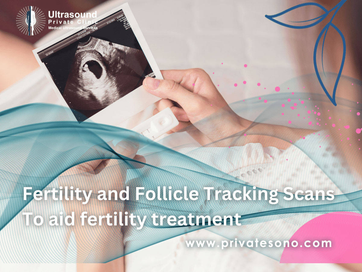 Fertility & Follicle Tracking Scans to fertility treatment