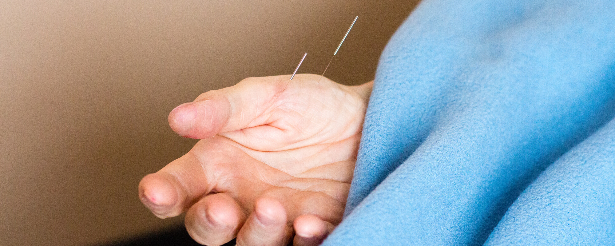 Professional Acupuncture & Physical Therapy Acupuncture in Duluth, MN