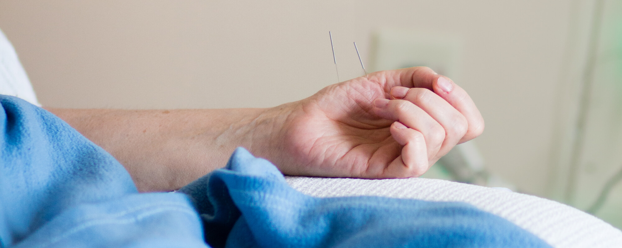 Services » Professional Acupuncture & Physical Therapy Acupuncture in