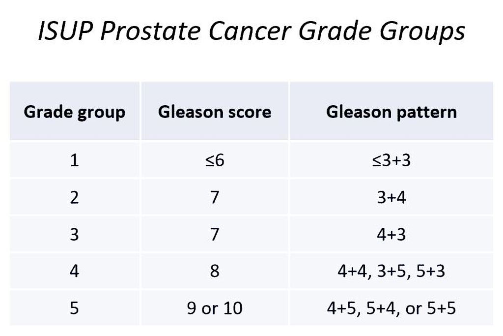 prostate cancer is the most common cancer among men. Isup Prostate Cancer Grade Groups Table Radiology Case Radiopaedia Org