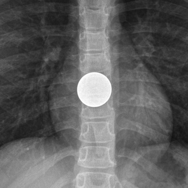 Coin vs battery Image