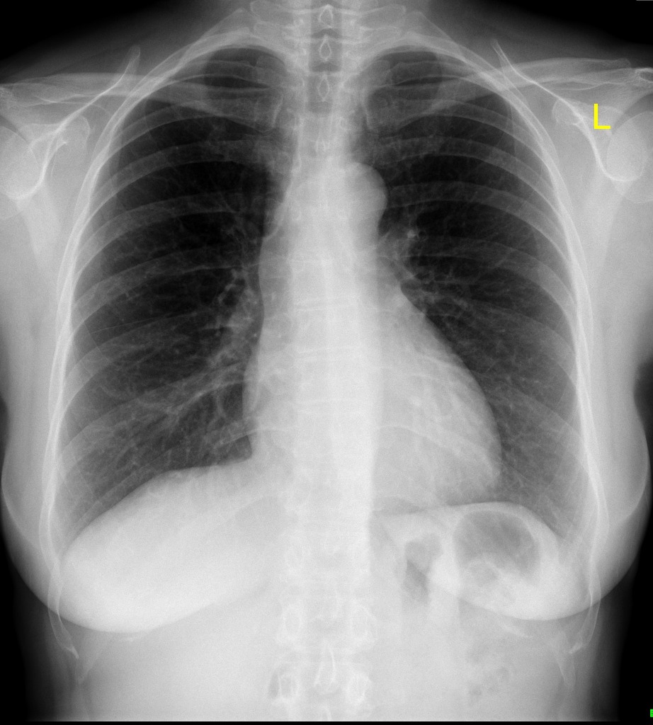 Imaging Reference Guide r/CovidCaseReports