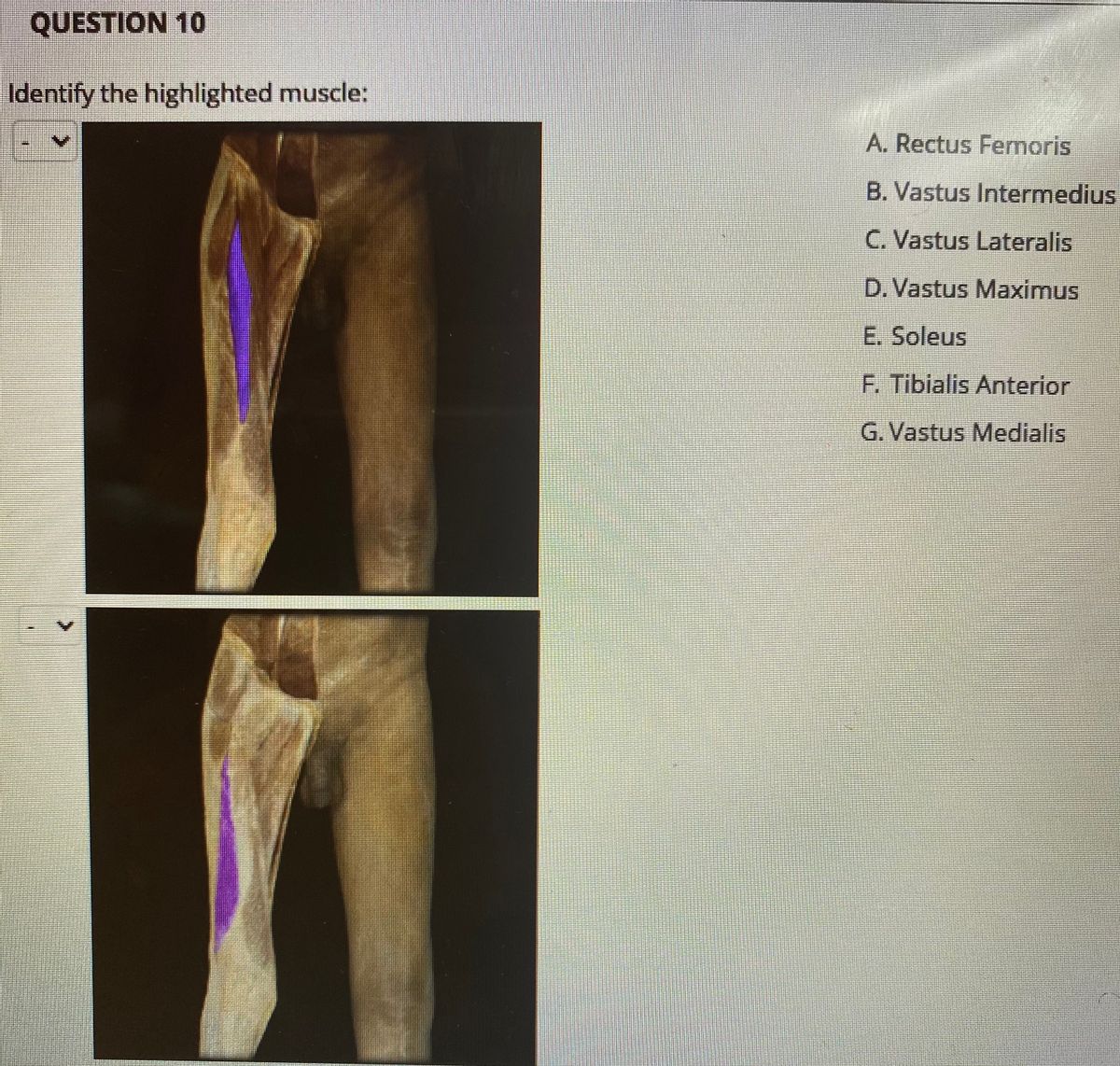 Answered Identify the highlighted muscle A.… bartleby