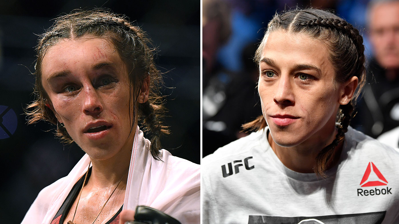 UFC Joanna Jedrzejczyk's swollen forehead steals the show at UFC 248