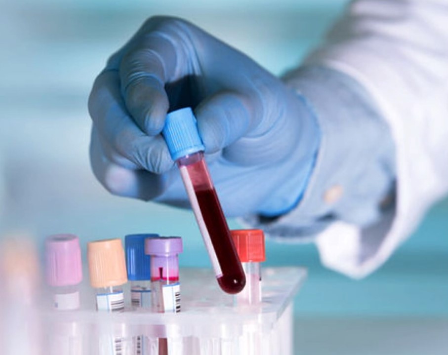What is PRP Treatment in IVF? ISTANBUL IVF CENTER Infertility and