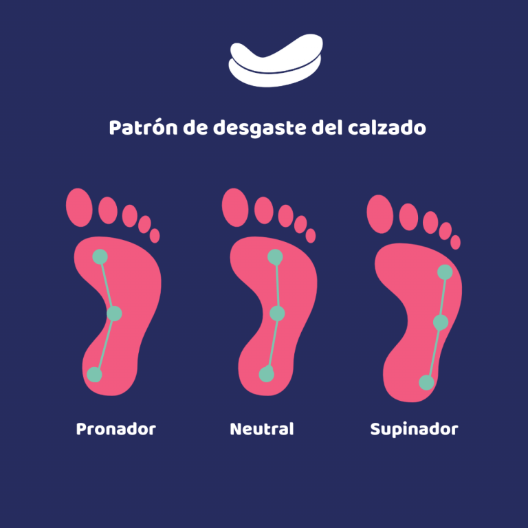 Existen tipos de Pisada? PROFEET Plantillas Ortopedicas