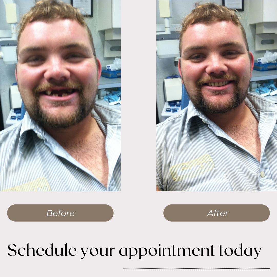 Dentures & Dental Implants Professional Denture Clinic Shreveport, LA