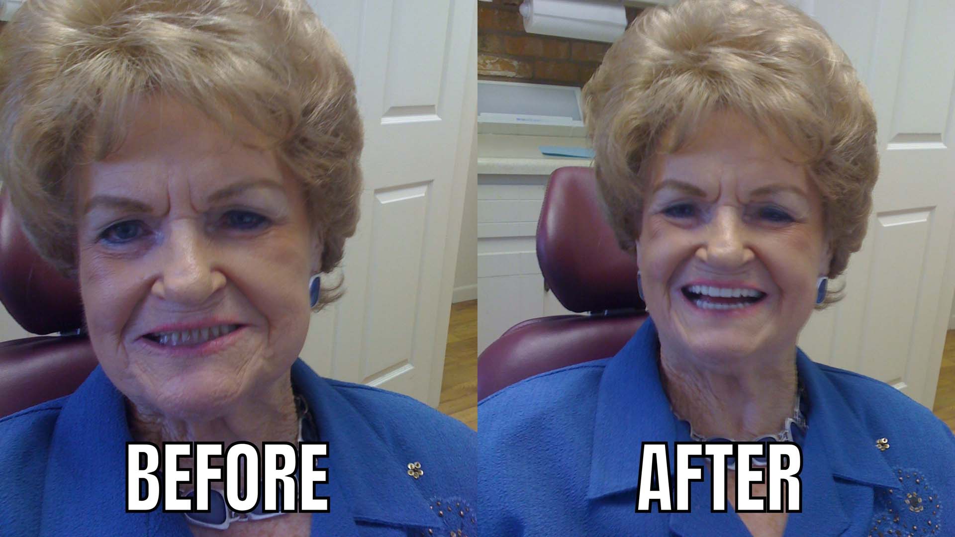 Dentures & Dental Implants Professional Denture Clinic Shreveport, LA