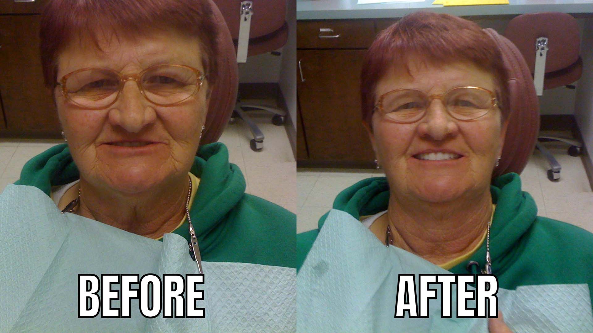 Dentures & Dental Implants Professional Denture Clinic Shreveport, LA