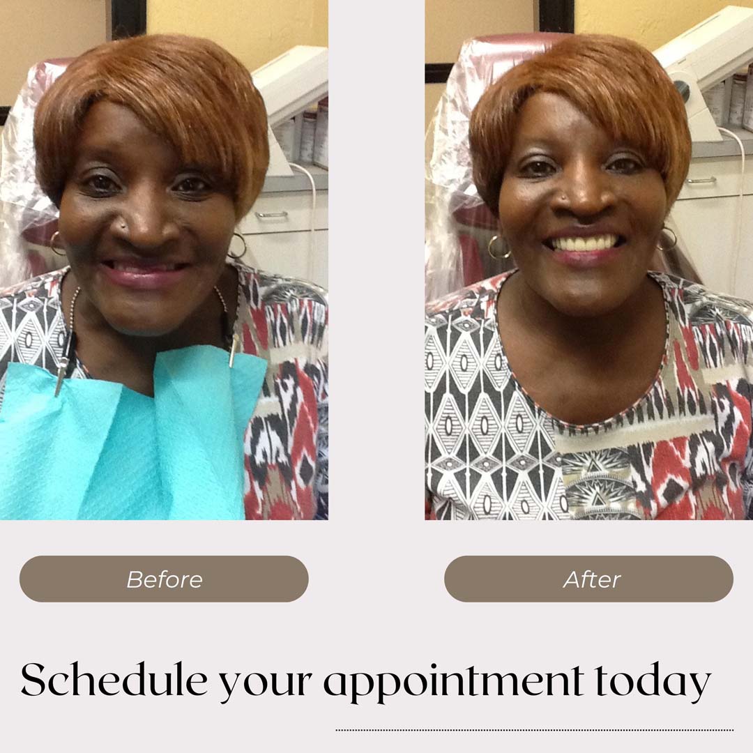 Dentures & Dental Implants Professional Denture Clinic Shreveport, LA