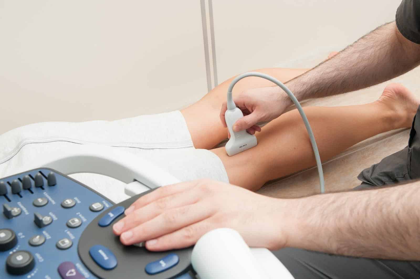 Varicose Veins Finding Relief From the Summer Heat Radiology