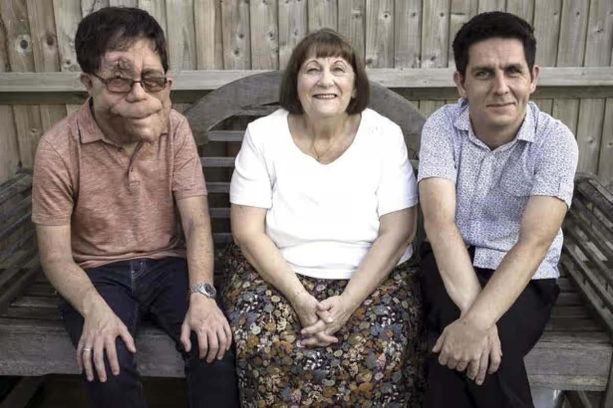 Adam Pearson Biography Net Worth Wife Parents Career
