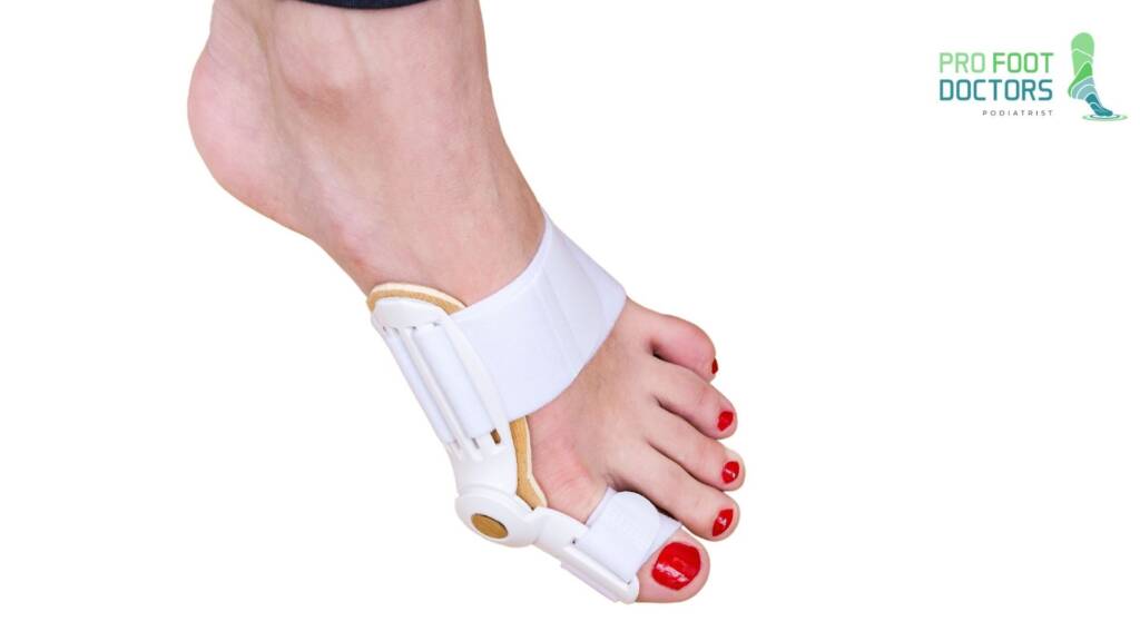 Bunion Splints Correct Foot Deformities? Pro Foot Doctors