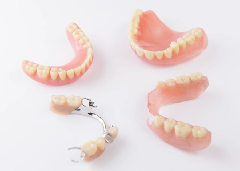 What to Expect with Complete & Partial Denture Services in Calgary