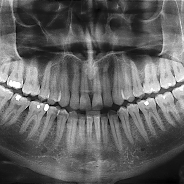 Dental XRays It’s Time For Your CloseUp Huntingdon Valley PA