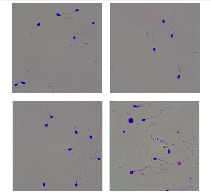 How do you do stain to evaluate sperm morphology?
