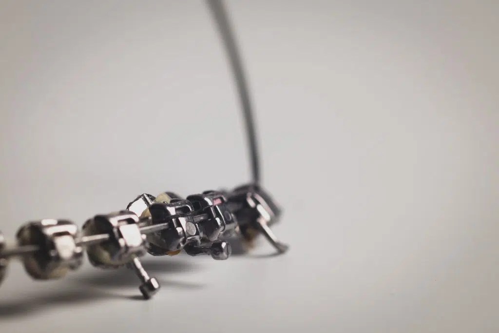 Precious Metal Plating on Dental Components ProPlate®