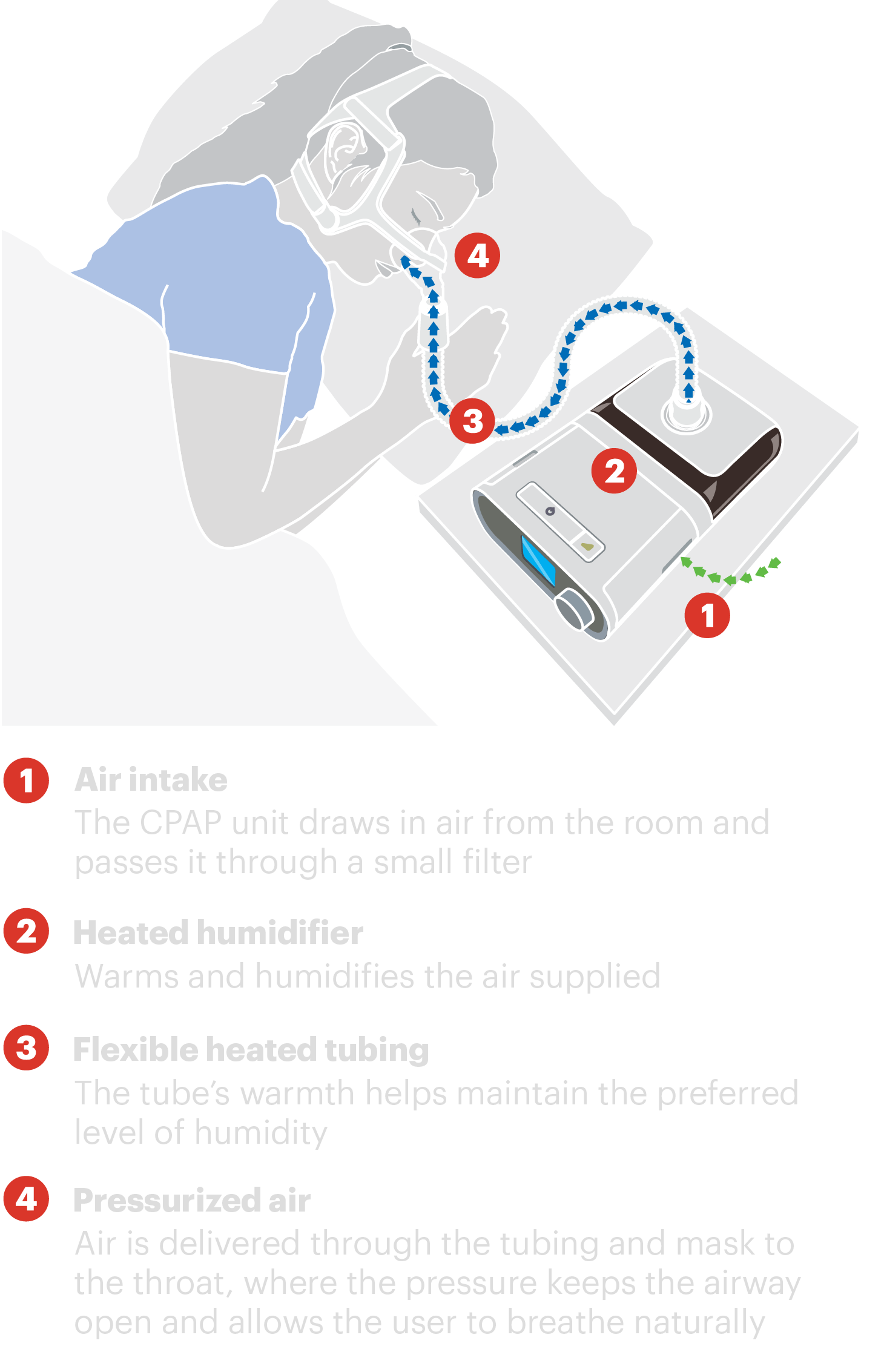 Philips Kept Complaints About Dangerous CPAP Machines Secret While