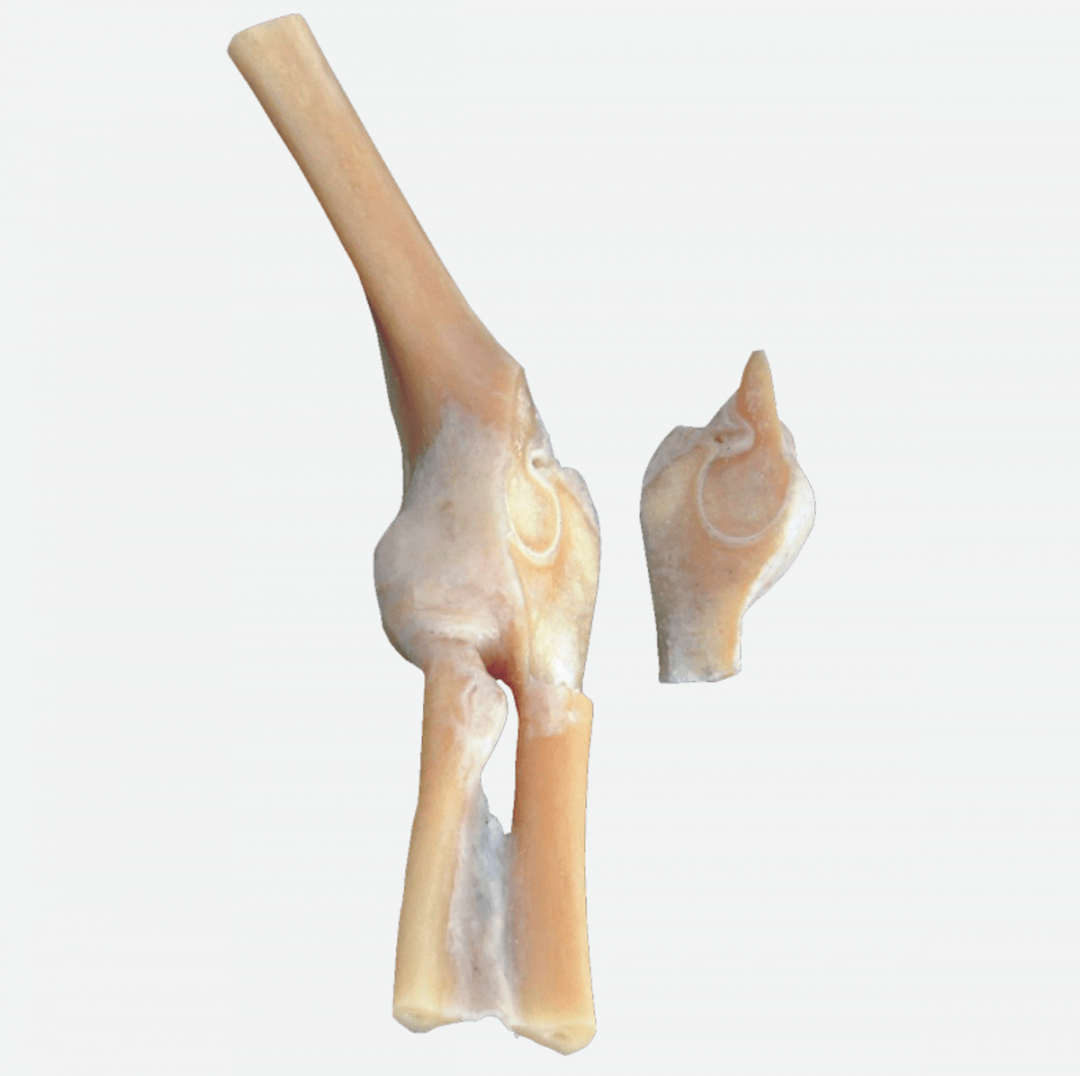 P1007 Bony Elbow Joint Prosections