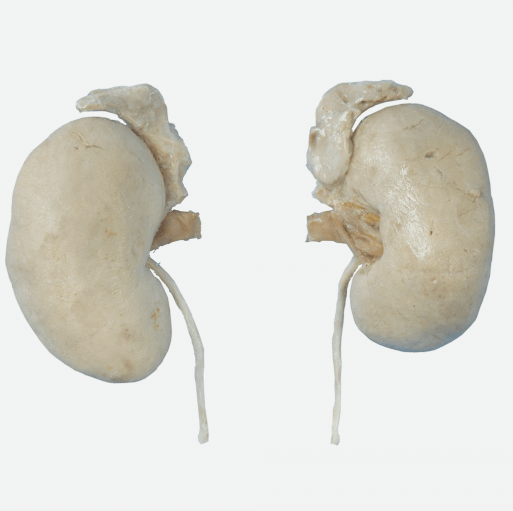 P4224 Kidney with Adrenal Gland Prosections