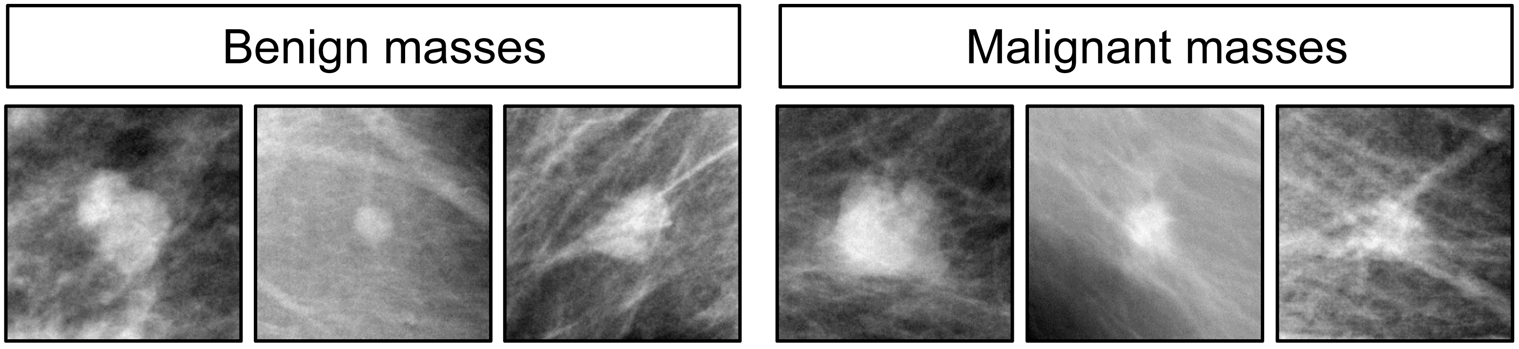 Healthcare Analytics A Breast Cancer Application ProSensus