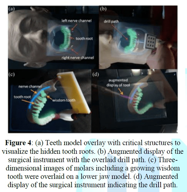 Augmented Reality in Dentistry Uses and Applications in the Digital