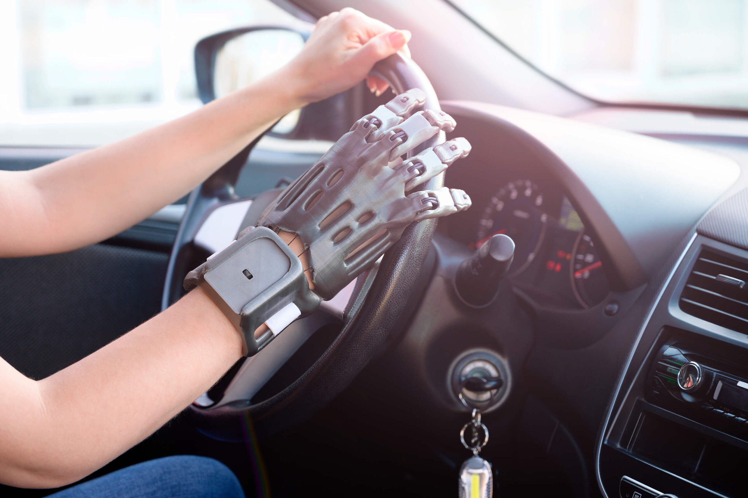 How Do Amputees Drive with a Prosthesis? Prosthetic1
