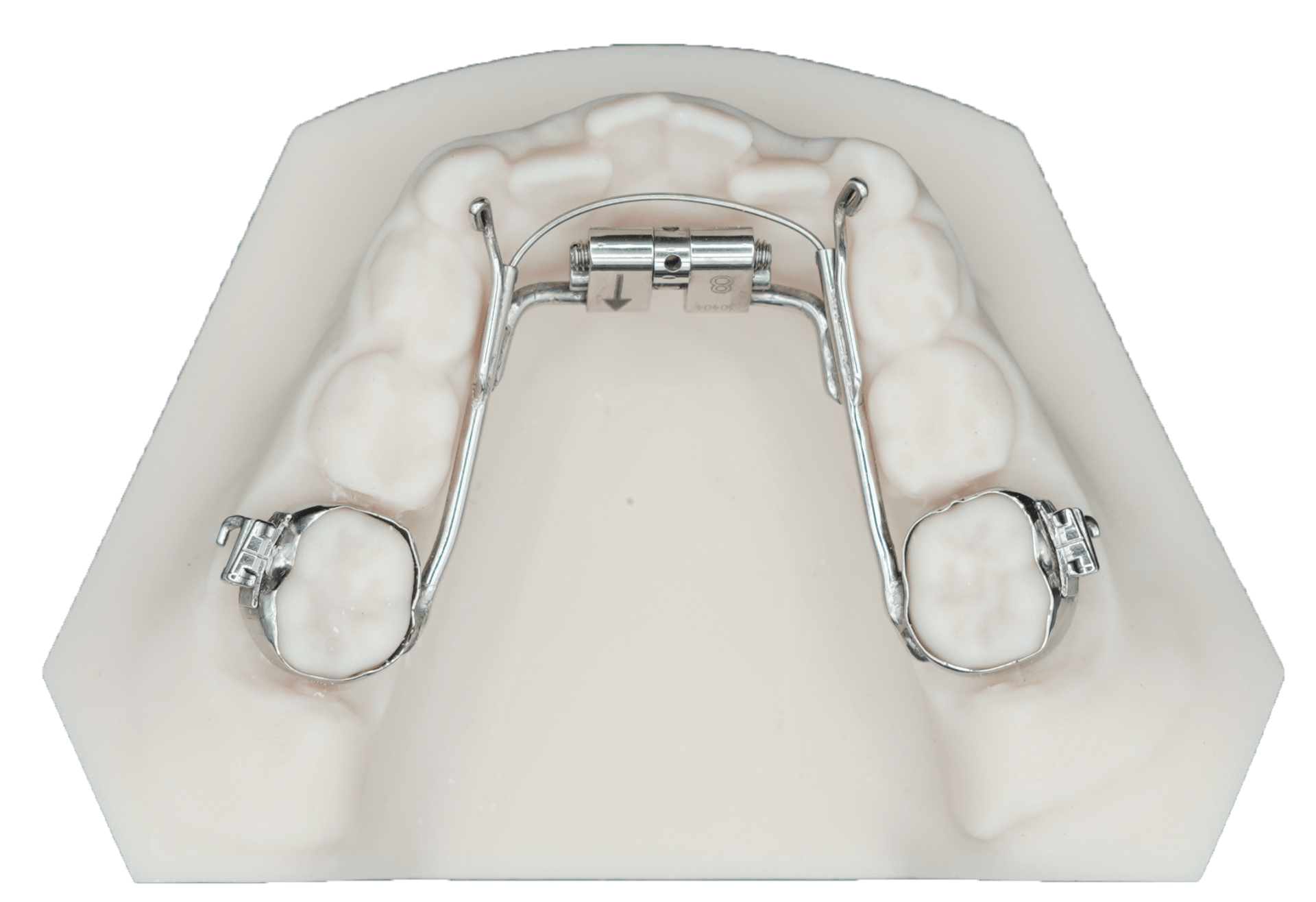 Lower Arch Expander