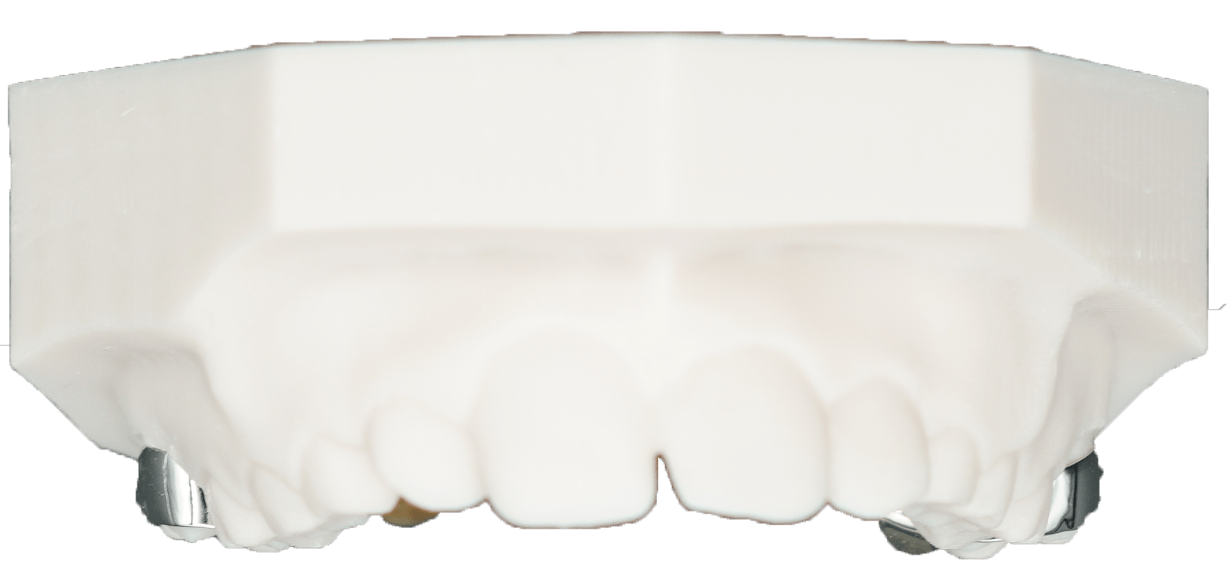 Palatal Expansion Archives Protec Dental