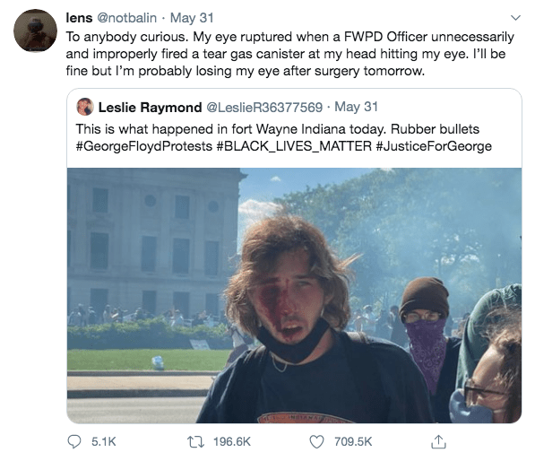 Tear gases and rubber bullets can cause permanent eye damage, eye