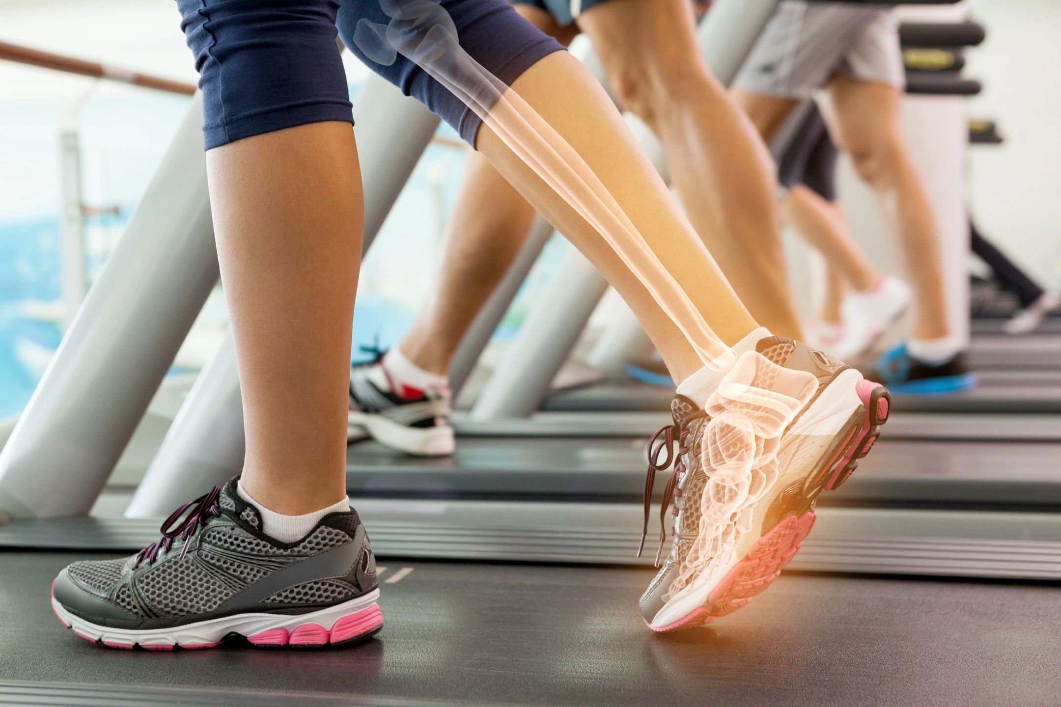 How do custom orthotics reduce foot pain and fatigue? Protherapy