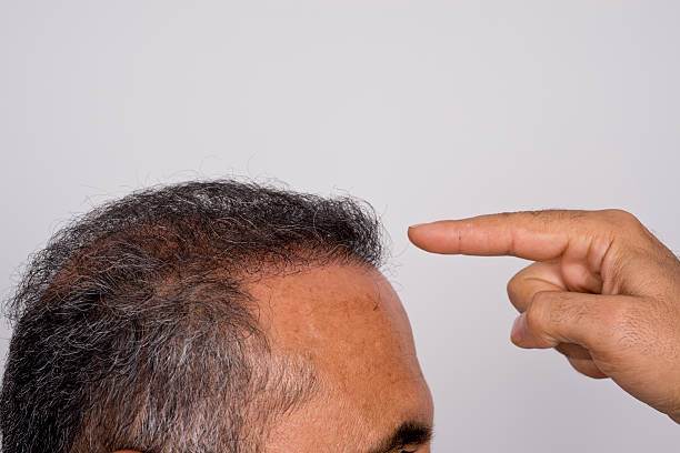 تجربتي مع الدكتور شادي زارع