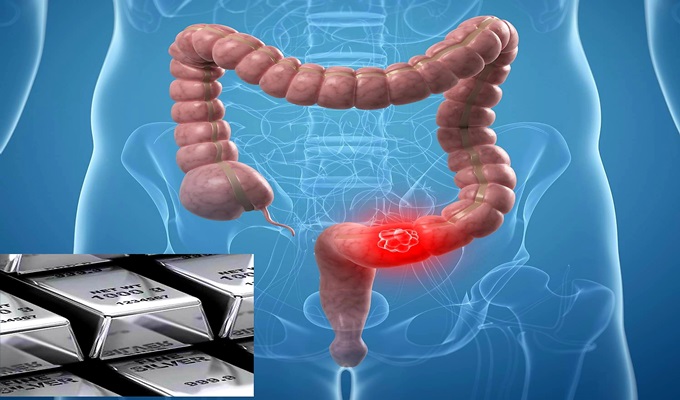 علاج القولون بالفضه الان مضى اسبوعين على تجربتي