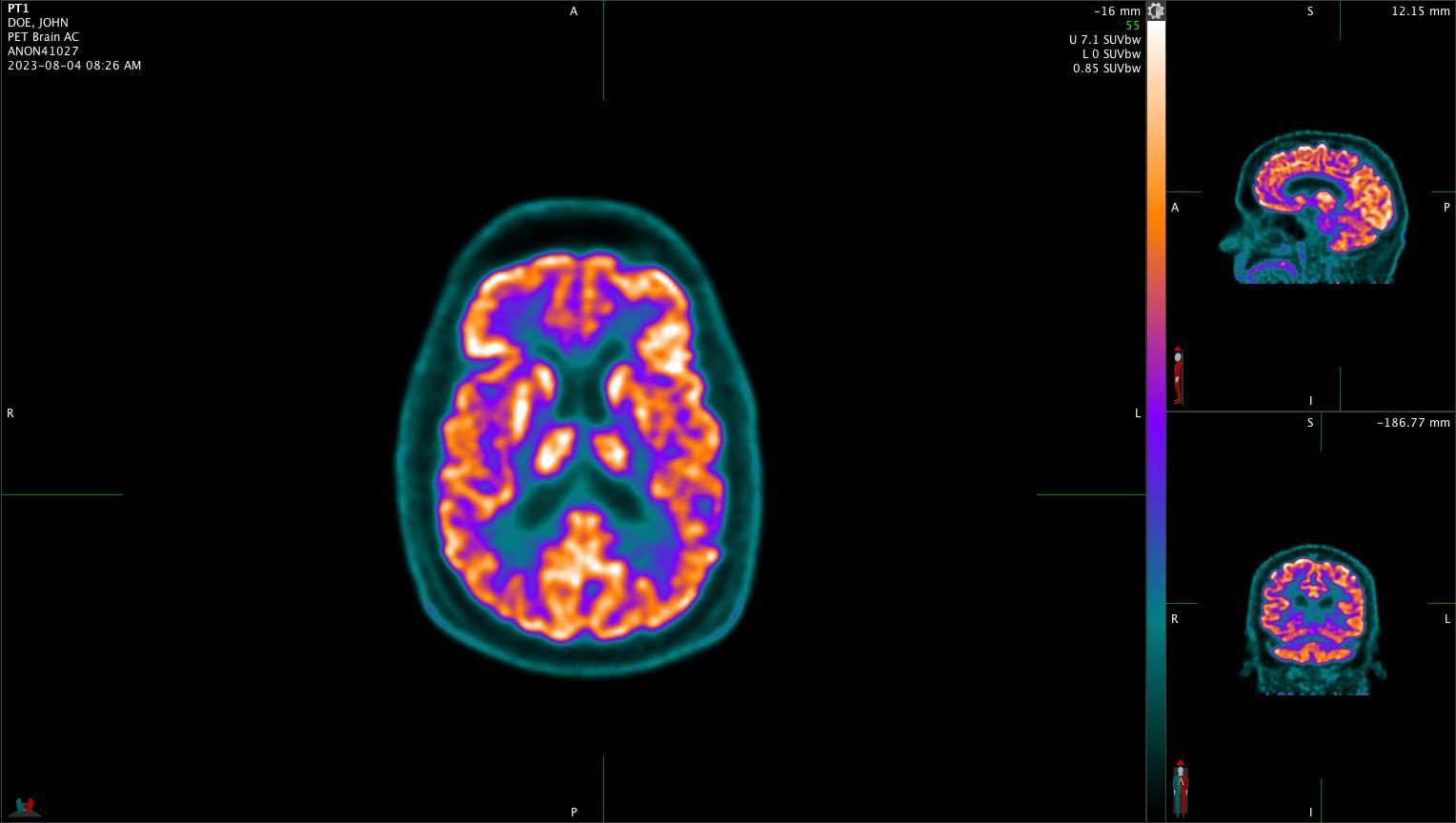 Blog Provision Diagnostic Imaging