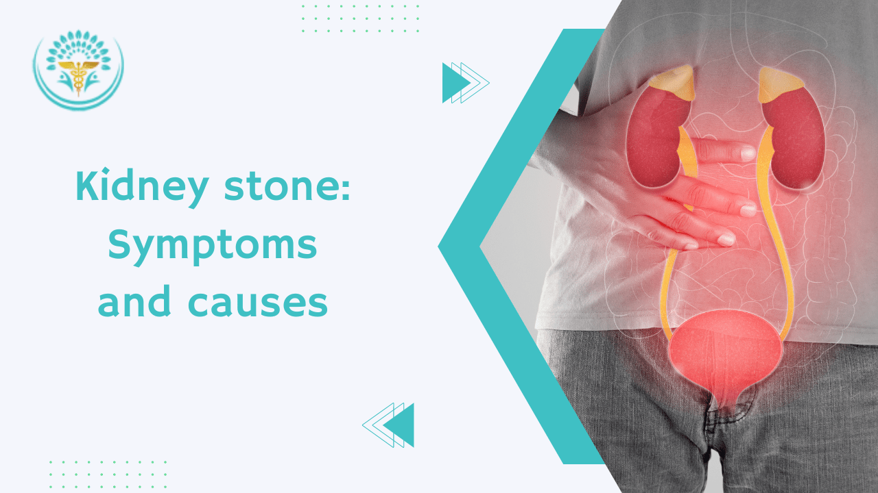 Kidney Stone Symptoms And Causes