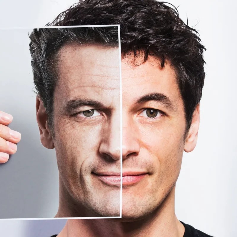 Different Ways How to prevent skin Ageing effects and reduce wrinkles ProWellness Mantra Dr