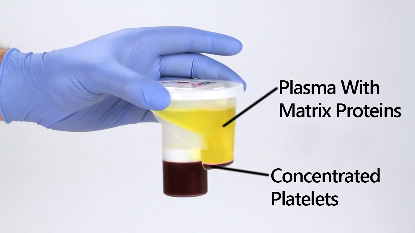 Back 4 blood doc build pushtiklo