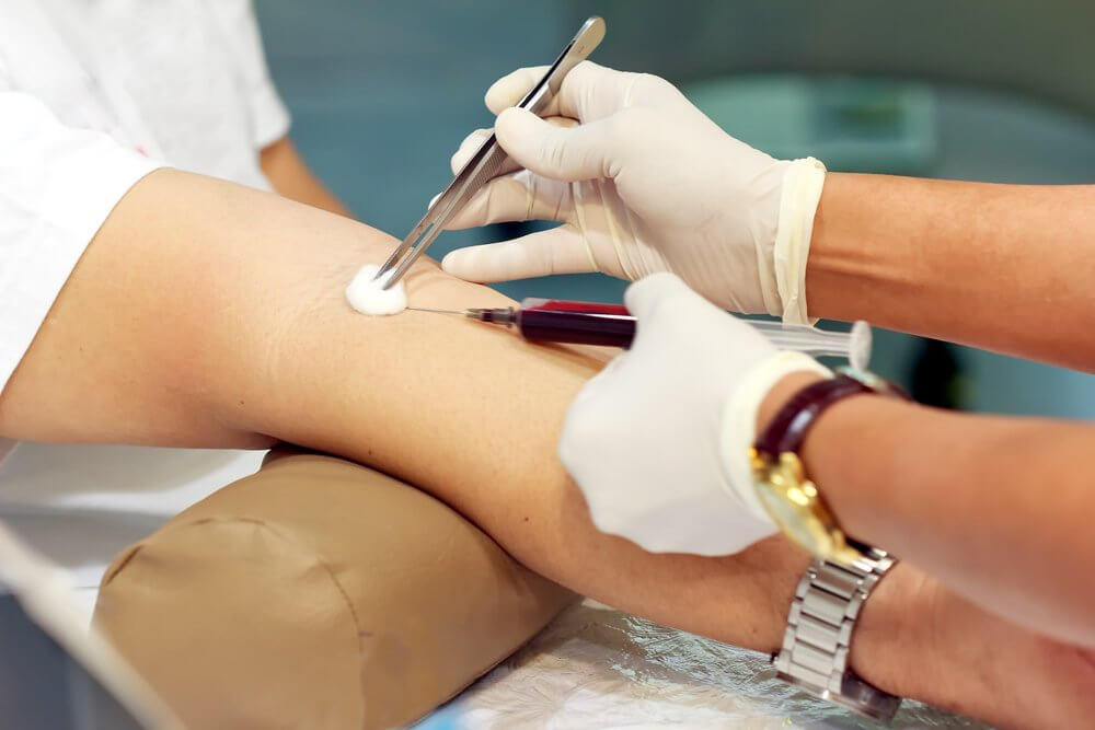 PRP Injection Contraindications Preventing Possible PRP Side Effects