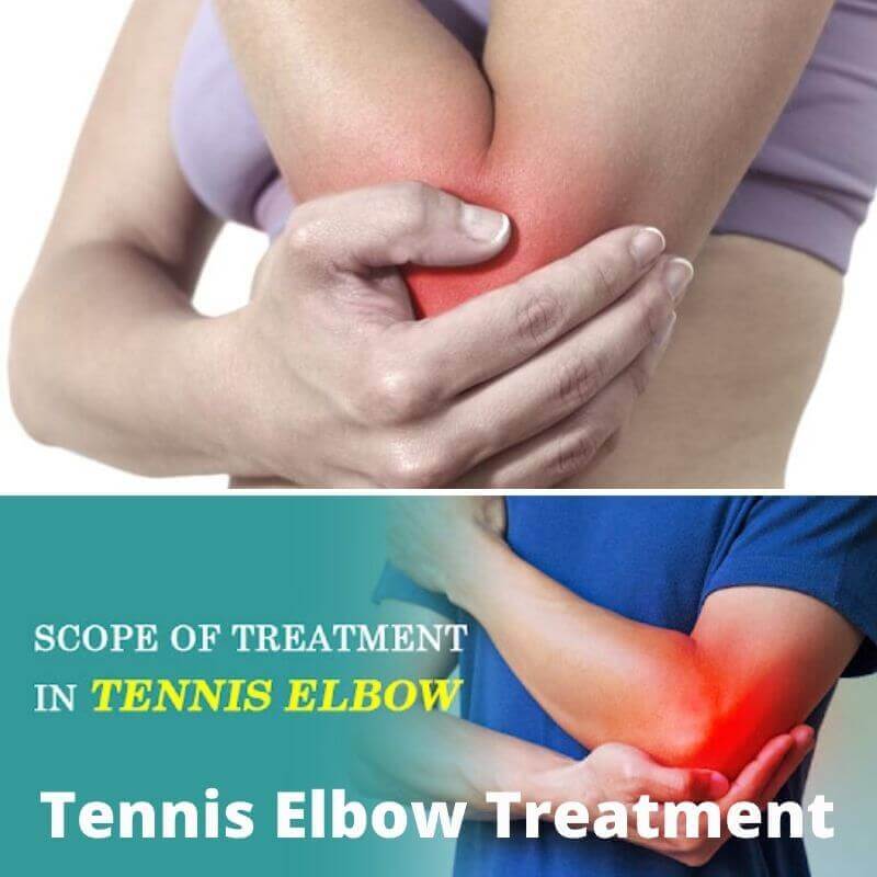 Tennis Elbow Treatment PRP Treatment center