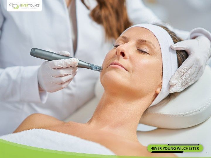 Why Microneedling in Wilchester Houston, TX is The Ultimate Beautifying
