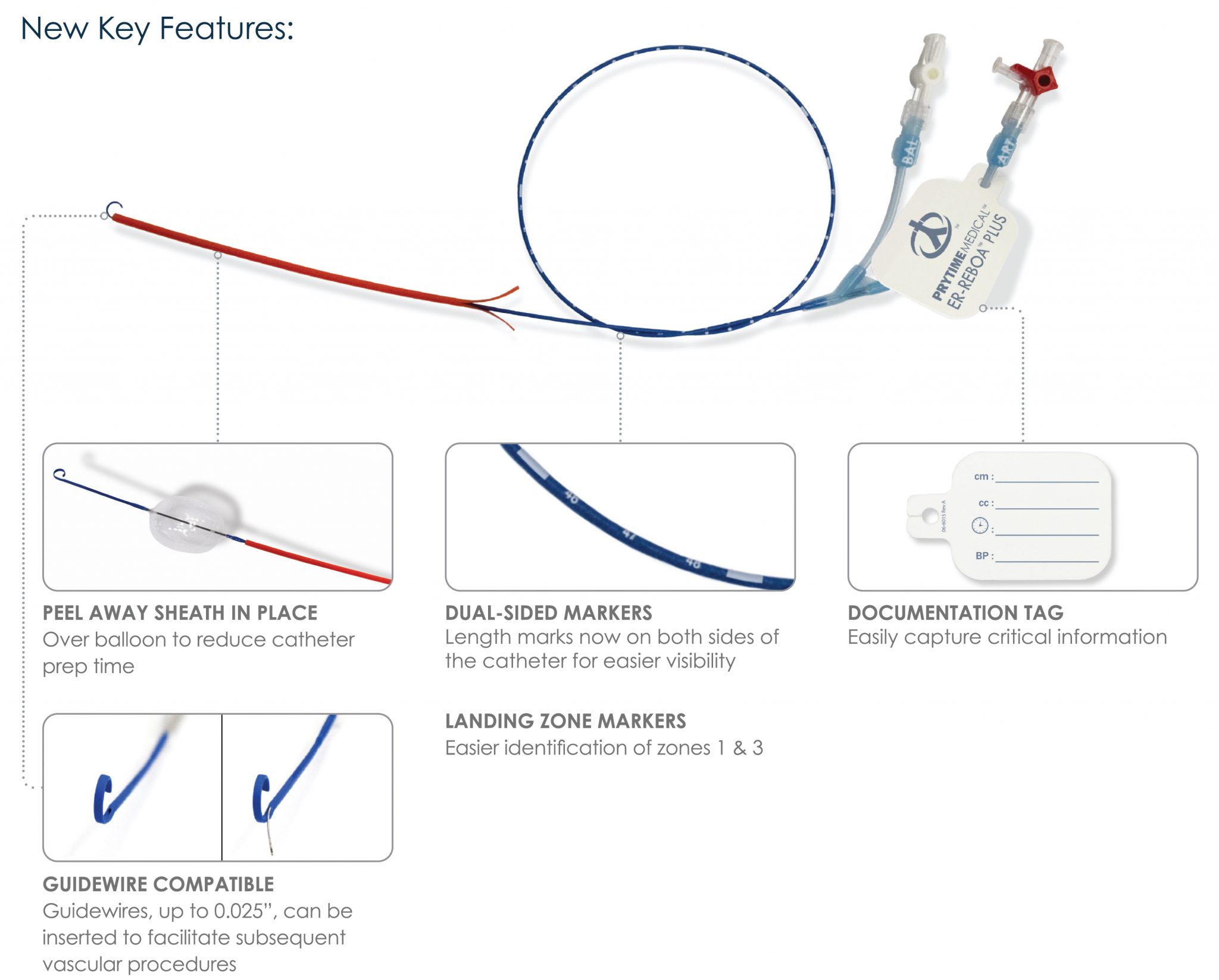ERREBOA™ PLUS Catheter Prytime Medical