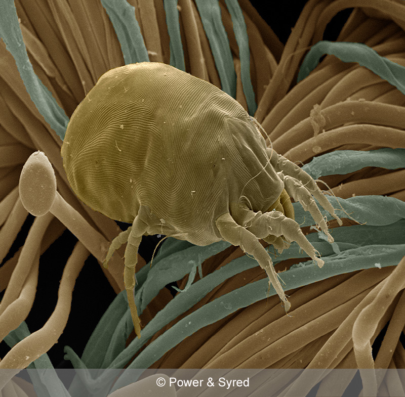 Dust mite in fabric x500 25mm PS micrographs